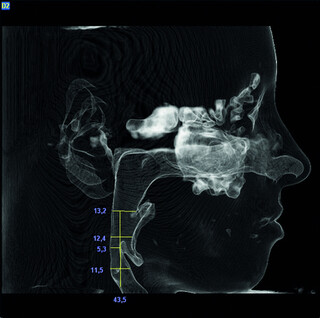 csm_5GXL_MIRIAM_D02_MKG_Klinik_Manhagen