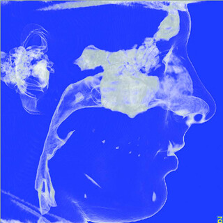 csm_5GXL_18x16_FULL_Skull_Davide__MKG_Klinik_Manhagen