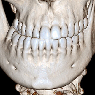 Roentgen_Kiefer_MKG_Klinik_Manhagen