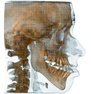 csm_5GXL_ORTO_4_2_MKG_Kiefer